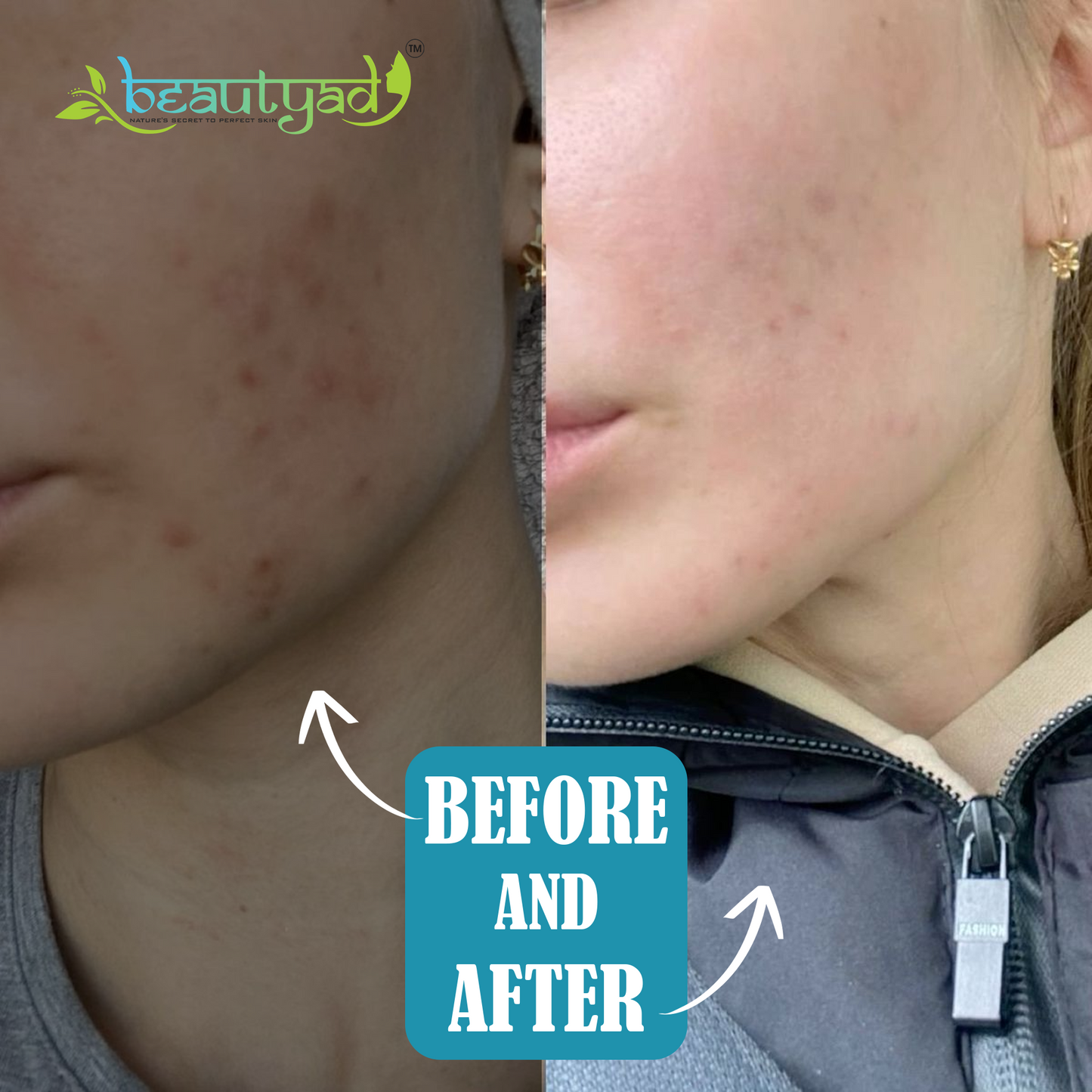 Hyaluronic Acid Face Serum